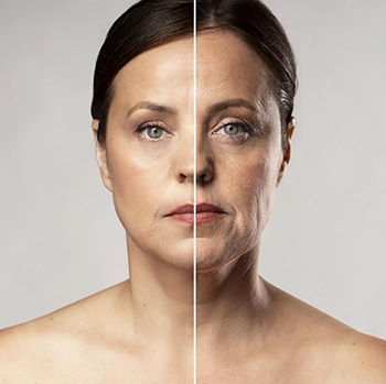 biosestimuladores procedimentos esteticos florianopolis SC