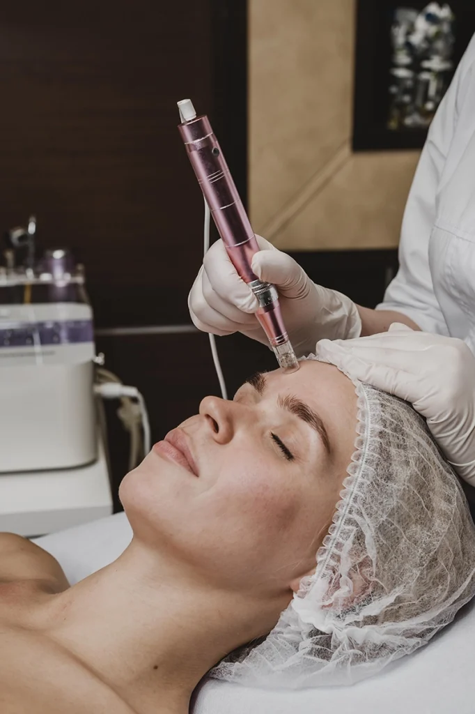 microagulhamento clinica estetica florianopolis sc