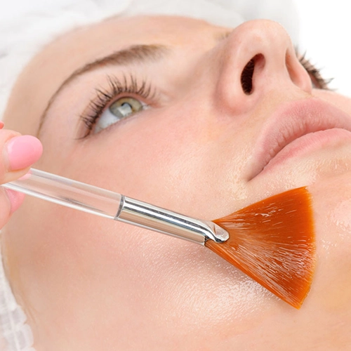 peeling quimico florianopolis-SC