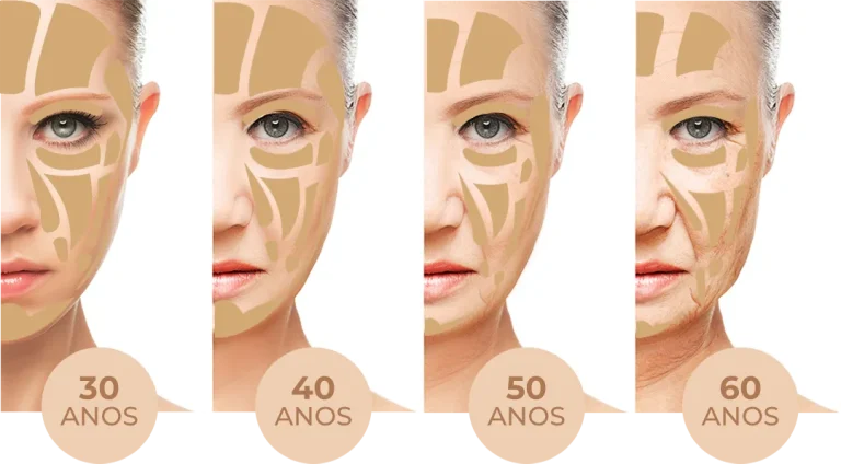 Bioestimuladores de colágeno para estética facial e corporal